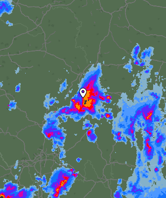 Radar