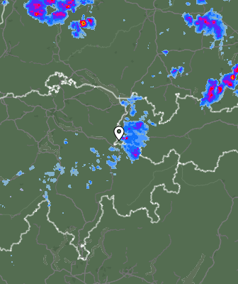 Radar