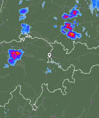 Radar