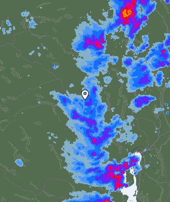 Radar