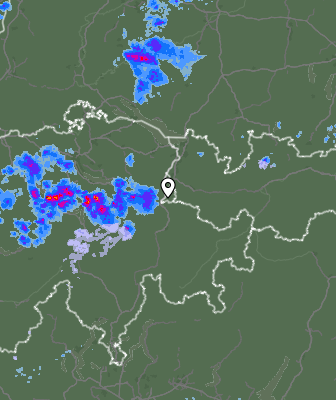 Radar