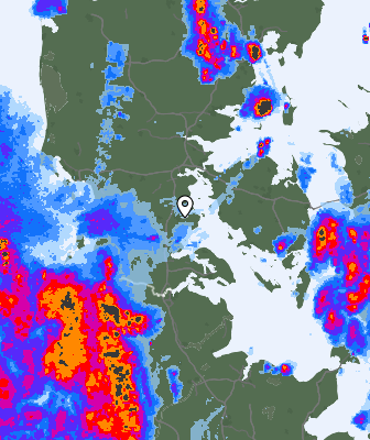 Radar
