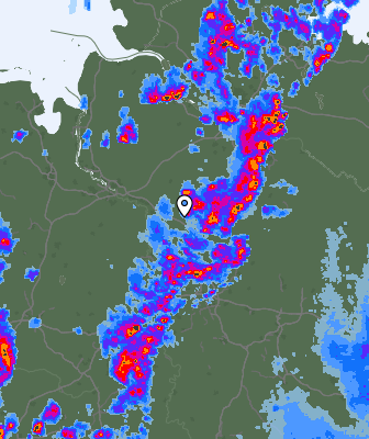 Radar