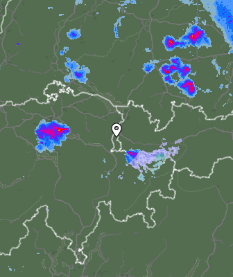 Radar