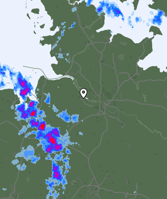 Radar
