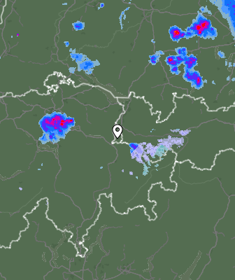 Radar