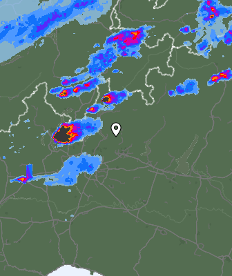 Radar