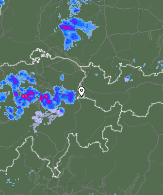 Radar
