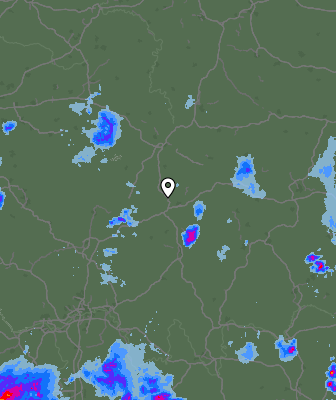 Radar