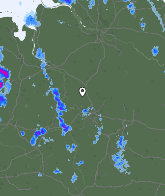Radar
