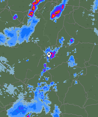 Radar
