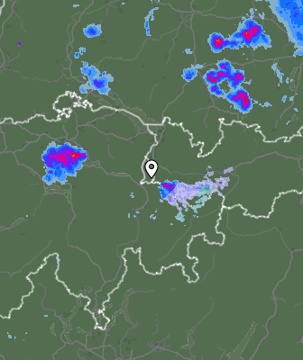 Radar