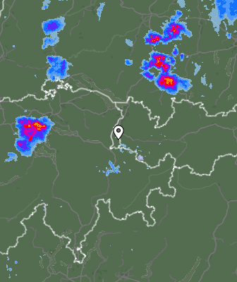 Radar
