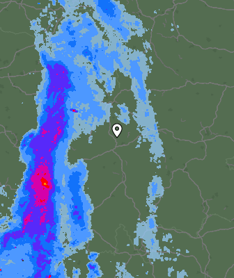 Radar