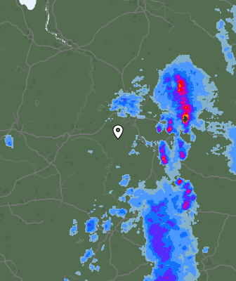 Radar