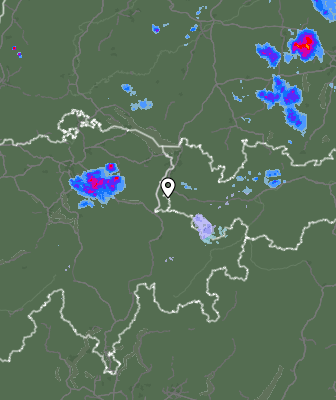 Radar