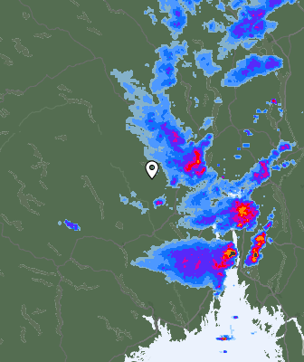 Radar