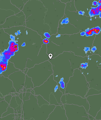 Radar