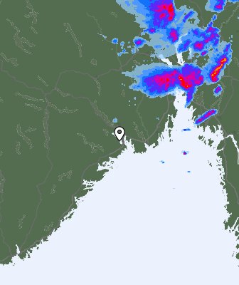 Radar