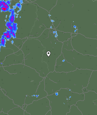 Radar