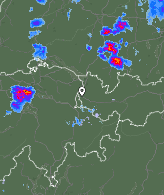 Radar