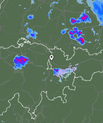 Radar