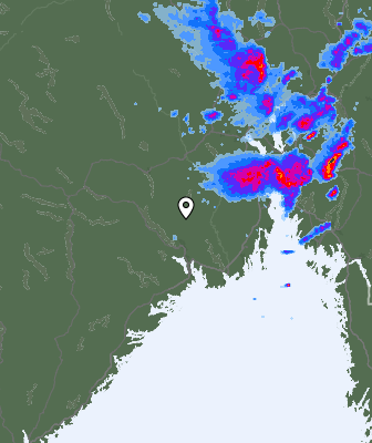 Radar