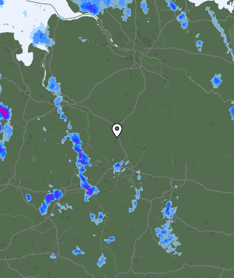 Radar
