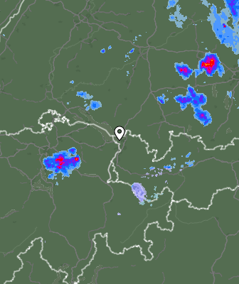 Radar