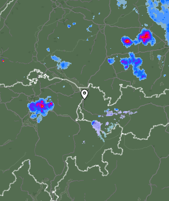 Radar