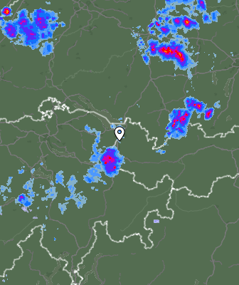 Radar