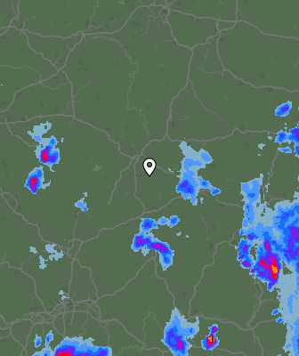 Radar
