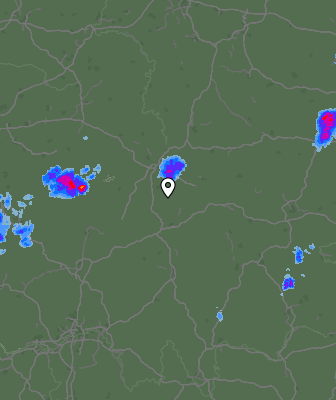 Radar