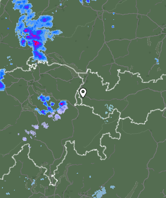 Radar