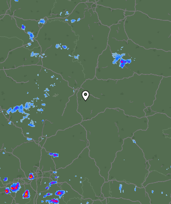 Radar