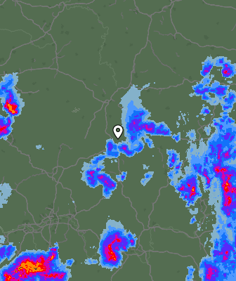Radar