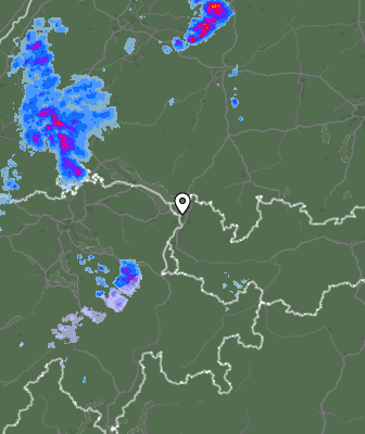 Radar
