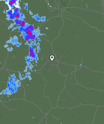 Radar