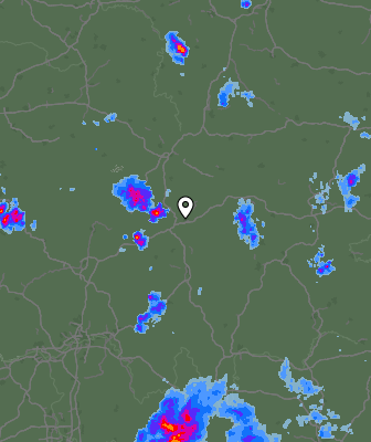Radar