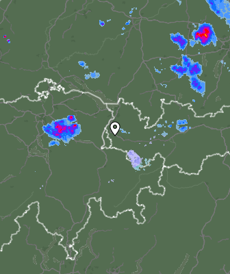 Radar