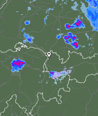 Radar