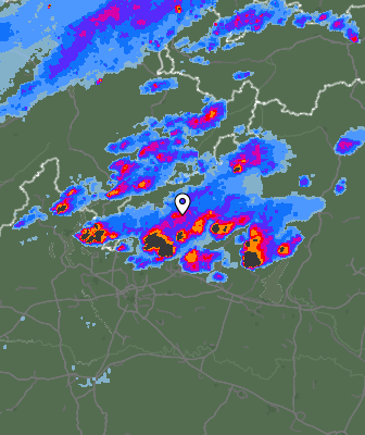 Radar