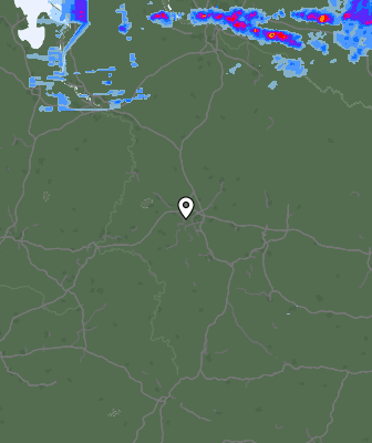 Radar