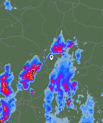 Radar