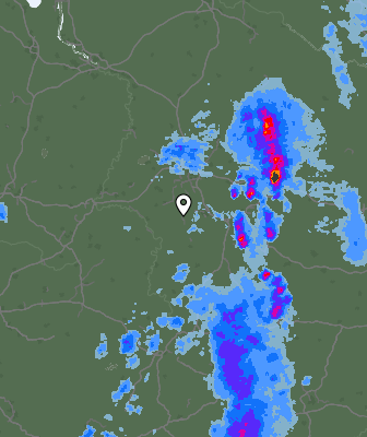 Radar