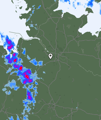 Radar