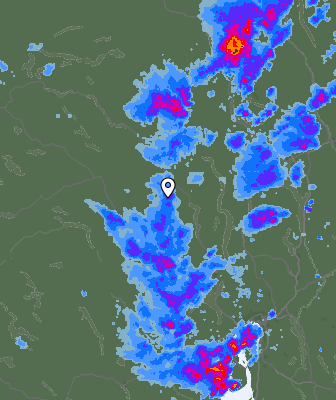Radar