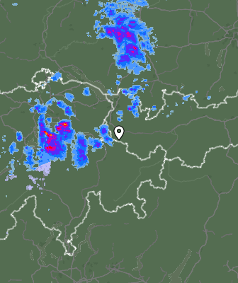 Radar