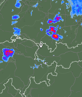Radar