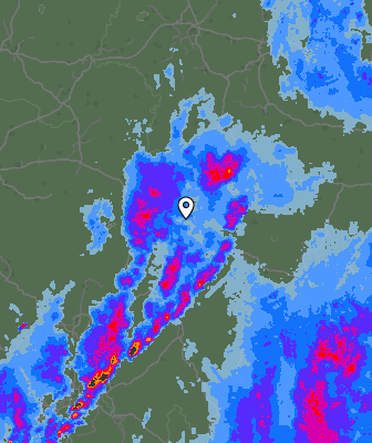 Radar
